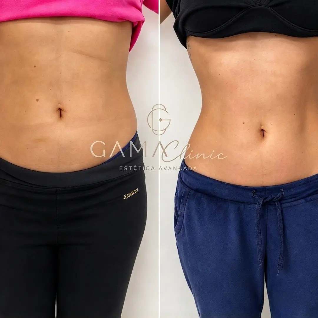 Antes e depois corporal